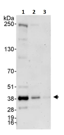 Western blot - Anti-PP1C gamma antibody (AB245664)