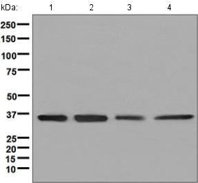 Western blot - Anti-PP1C gamma antibody [EPR8934] (AB134947)