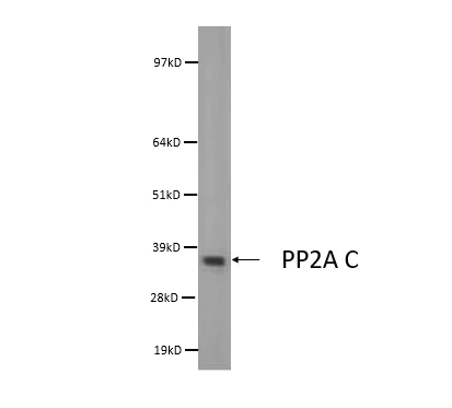 Western blot - Anti-PP2A-alpha Antibody [7A6] - C-terminal (AB316347)