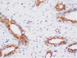 Immunohistochemistry (Formalin/PFA-fixed paraffin-embedded sections) - Anti-PP2A-alpha antibody (AB106262)