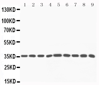 Western blot - Anti-PP2A-alpha antibody (AB106262), expandable thumbnail