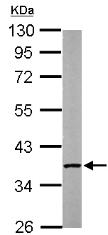 Western blot - Anti-PP2A-alpha antibody (AB137825), expandable thumbnail