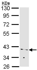 Western blot - Anti-PP2A-alpha antibody (AB137825), expandable thumbnail