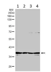Western blot - Anti-PP2A-alpha antibody - C-terminal (AB226790)