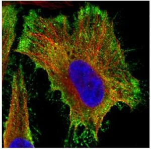 Immunocytochemistry/ Immunofluorescence - Anti-PP2A alpha + beta antibody (AB137849)
