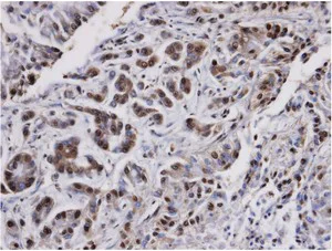 Immunohistochemistry (Formalin/PFA-fixed paraffin-embedded sections) - Anti-PP2A alpha + beta antibody (AB137849)