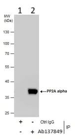 Immunoprecipitation - Anti-PP2A alpha + beta antibody (AB137849)