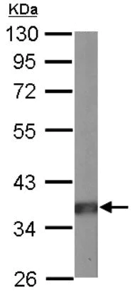 Western blot - Anti-PP2A alpha + beta antibody (AB137849)
