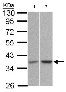 Western blot - Anti-PP2A alpha + beta antibody (AB137849)