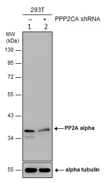 Western blot - Anti-PP2A alpha + beta antibody (AB137849)