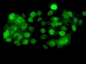 Immunocytochemistry/ Immunofluorescence - Anti-PP2A alpha + beta antibody [EPR11787(B)] (AB168350)