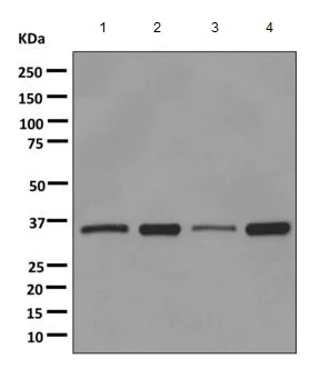 Western blot - Anti-PP2A alpha + beta antibody [EPR11787(B)] (AB168350)