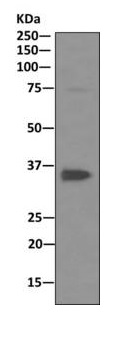 Western blot - Anti-PP2A alpha + beta antibody [EPR11787(B)] (AB168350)