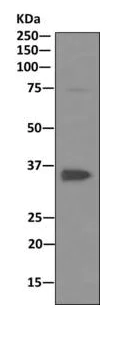 Western blot - Anti-PP2A alpha + beta antibody [EPR11787(B)] - BSA and Azide free (AB249449)