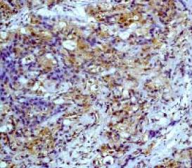 Immunohistochemistry (Formalin/PFA-fixed paraffin-embedded sections) - Anti-PP2A alpha + beta antibody [Y119] (AB32141), expandable thumbnail
