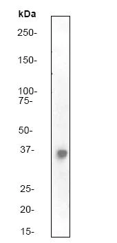 Western blot - Anti-PP2A alpha + beta antibody [Y119] (AB32141)
