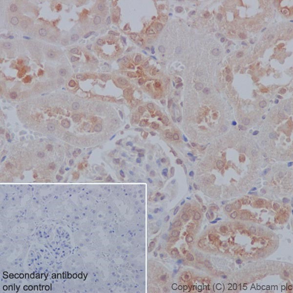 Immunohistochemistry (Formalin/PFA-fixed paraffin-embedded sections) - Anti-PP2A alpha + beta antibody [YE351] (AB32065)