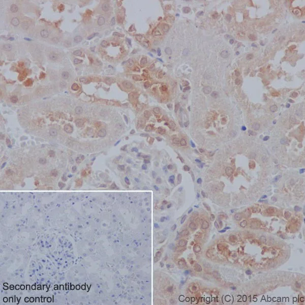 Immunohistochemistry (Formalin/PFA-fixed paraffin-embedded sections) - Anti-PP2A alpha + beta antibody [YE351] (AB32065)