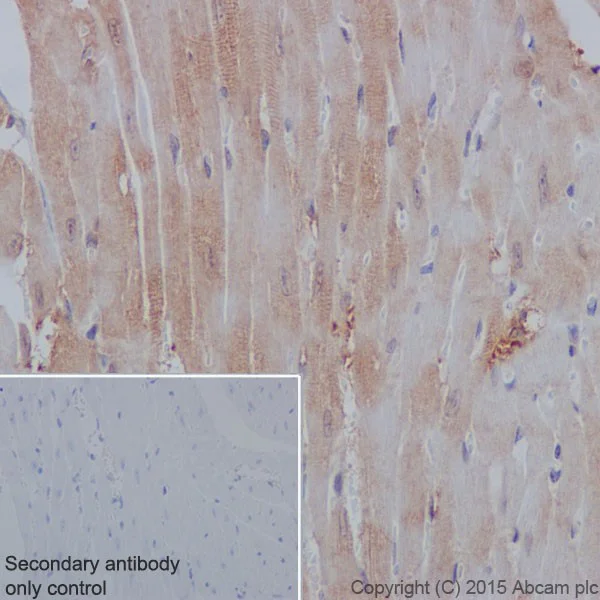 Immunohistochemistry (Formalin/PFA-fixed paraffin-embedded sections) - Anti-PP2A alpha + beta antibody [YE351] (AB32065)