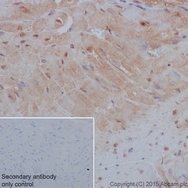 Immunohistochemistry (Formalin/PFA-fixed paraffin-embedded sections) - Anti-PP2A alpha + beta antibody [YE351] (AB32065)