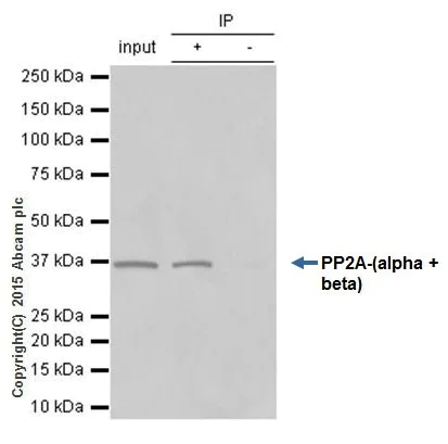 Immunoprecipitation - Anti-PP2A alpha + beta antibody [YE351] (AB32065)