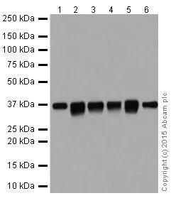 Western blot - Anti-PP2A alpha + beta antibody [YE351] (AB32065)