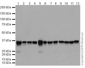 Western blot - Anti-PP2A alpha + beta antibody [YE351] (AB32065)