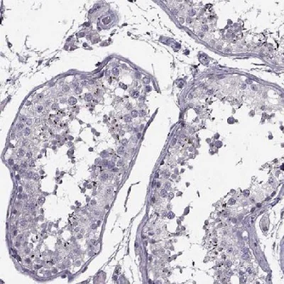 Immunohistochemistry (Formalin/PFA-fixed paraffin-embedded sections) - Anti-PP2D1 antibody (AB221636)