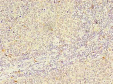 Immunohistochemistry (Formalin/PFA-fixed paraffin-embedded sections) - Anti-PP7 antibody (AB235601)