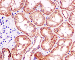 Immunohistochemistry (Formalin/PFA-fixed paraffin-embedded sections) - Anti-PPA2 antibody [EPR13086] (ab180859), expandable thumbnail