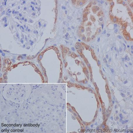 Immunohistochemistry (Formalin/PFA-fixed paraffin-embedded sections) - Anti-PPA2 antibody [EPR13086] (AB180859), expandable thumbnail