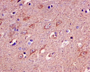 Immunohistochemistry (Formalin/PFA-fixed paraffin-embedded sections) - Anti-PPA2 antibody [EPR13086] (ab180859), expandable thumbnail