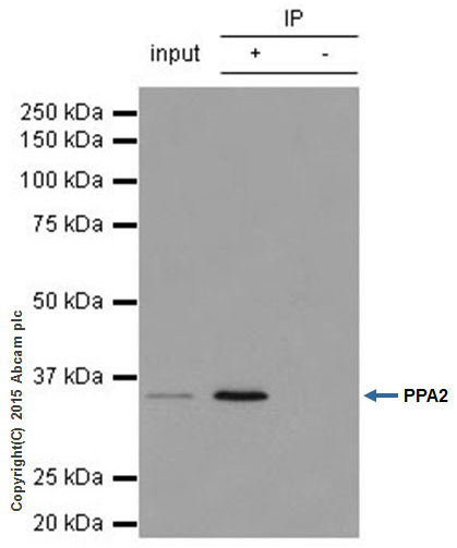 Immunoprecipitation - Anti-PPA2 antibody [EPR13086] (AB180859), expandable thumbnail