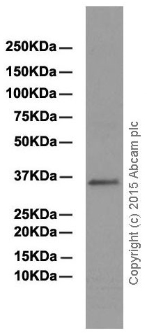 Western blot - Anti-PPA2 antibody [EPR13086] (AB180859), expandable thumbnail