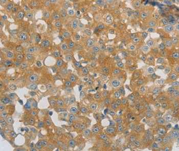 Immunohistochemistry (Formalin/PFA-fixed paraffin-embedded sections) - Anti-PPAP2A antibody (AB198280)