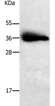 Western blot - Anti-PPAP2A antibody (AB198280)