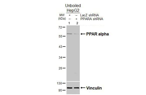 Western blot - Anti-PPAR alpha antibody (AB227074)
