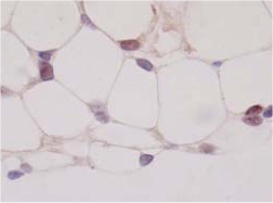 Immunohistochemistry (Formalin/PFA-fixed paraffin-embedded sections) - Anti-PPAR gamma 2 + PPAR gamma antibody [A3409A] (AB41928), expandable thumbnail