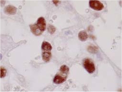 Immunohistochemistry (Formalin/PFA-fixed paraffin-embedded sections) - Anti-PPAR gamma 2 + PPAR gamma antibody [A3409A] (AB41928), expandable thumbnail