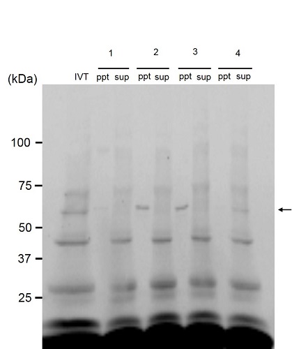 Immunoprecipitation - Anti-PPAR gamma 2 + PPAR gamma antibody [A3409A] (AB41928), expandable thumbnail