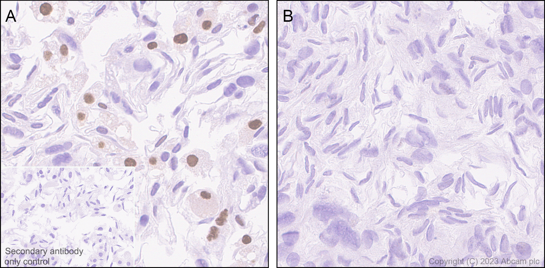 Immunohistochemistry (Formalin/PFA-fixed paraffin-embedded sections) - Anti-PPAR gamma 2 + PPAR gamma antibody [EPR25862-79] - BSA and Azide free (ab310324), expandable thumbnail