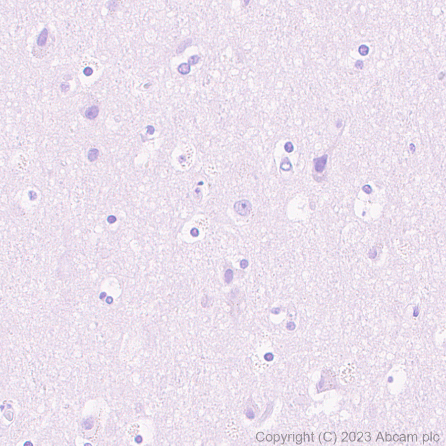 Immunohistochemistry (Formalin/PFA-fixed paraffin-embedded sections) - Anti-PPAR gamma 2 + PPAR gamma antibody [EPR25862-79] - BSA and Azide free (AB310324), expandable thumbnail