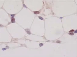 Immunohistochemistry (Formalin/PFA-fixed paraffin-embedded sections) - Anti-PPAR gamma antibody [A3409A] (AB41928)