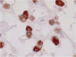 Immunohistochemistry (Formalin/PFA-fixed paraffin-embedded sections) - Anti-PPAR gamma antibody [A3409A] (AB41928)