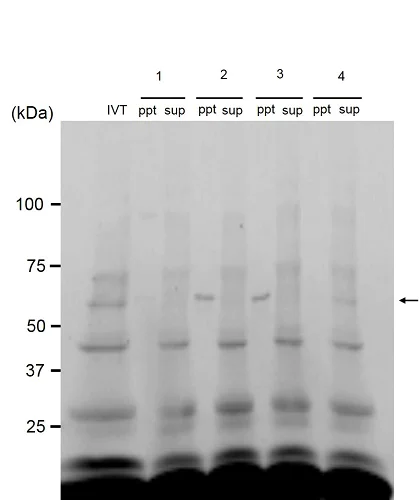 Immunoprecipitation - Anti-PPAR gamma antibody [A3409A] (AB41928)