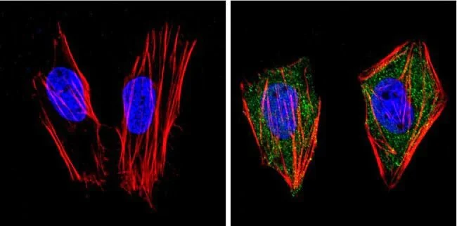 Immunocytochemistry - Anti-PPAR gamma antibody (AB209350)