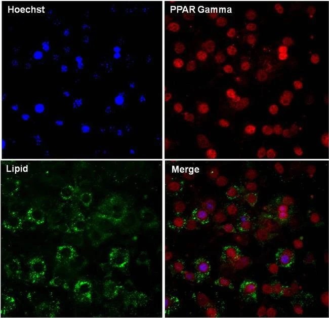 Anti-PPAR gamma antibody (ab209350) | Abcam