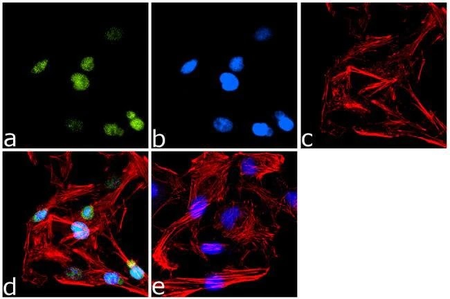 Anti-PPAR gamma antibody