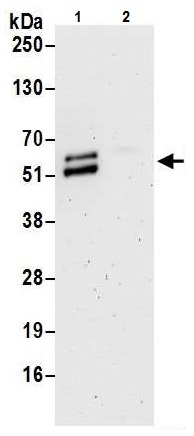 Immunoprecipitation - Anti-PPAR gamma antibody (AB226183)