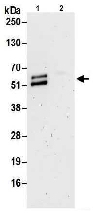 Immunoprecipitation - Anti-PPAR gamma antibody (AB226183)